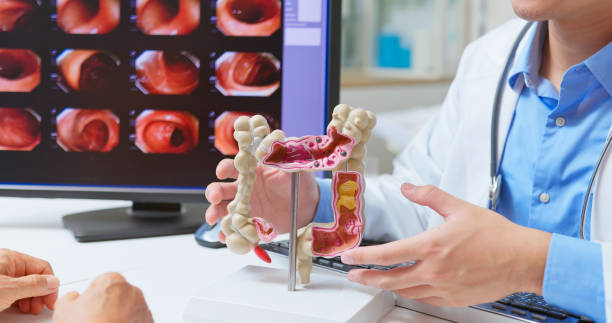 What Happens If You Take Multivitamins Before a Colonoscopy?